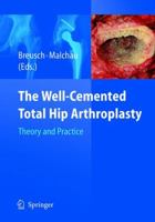 The Well Cemented Total Hip Arthroplasty:  Theory And Practice 3540241973 Book Cover