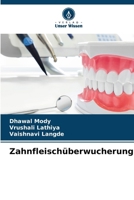 Zahnfleischüberwucherung (German Edition) 6208739535 Book Cover