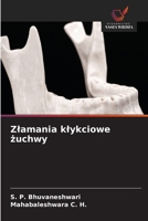 Zlamania klykciowe zuchwy (Polish Edition) 6630083903 Book Cover