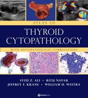 Atlas of Thyroid Cytopathology: With Histopathologic Correlations 1933864958 Book Cover
