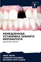 &#1053;&#1045;&#1052;&#1045;&#1044;&#1051;&#1045;&#1053;&#1053;&#1040;&#1071; &#1059;&#1057;&#1058;&#1040;&#1053;&#1054;&#1042;&#1050;&#1040; &#1047;& 6203216518 Book Cover