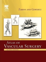 Atlas Of Vascular Surgery 0443084866 Book Cover