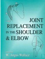 Joint Replacement in the Shoulder and Elbow 075061367X Book Cover