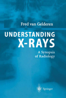 Understanding X-Rays: A Synopsis of Radiology 3642623670 Book Cover