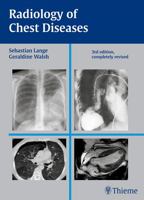 Radiology of Chest Diseases 0865773130 Book Cover