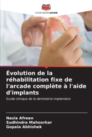 Évolution de la réhabilitation fixe de l'arcade complète à l'aide d'implants 6206615456 Book Cover