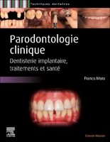 Parodontologie: Maladie Parodontale, Décision Thérapeutique, Traitements, Implantologie 2294781880 Book Cover