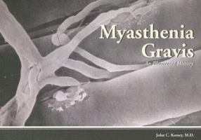 Myasthenia Gravis: An Illustrated History 1929170041 Book Cover