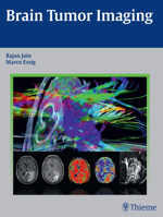 Brain Tumor Imaging 160406806X Book Cover