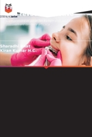 Friction en orthodontie: une revue exhaustive (French Edition) 6208468132 Book Cover