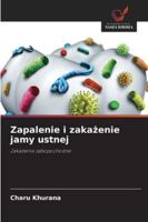 Zapalenie i zakazenie jamy ustnej: Zakazenia zebopochodne (Polish Edition) 6208712947 Book Cover