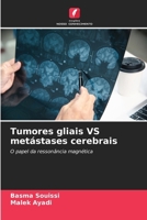 Tumores gliais VS metástases cerebrais (Portuguese Edition) 6208219914 Book Cover