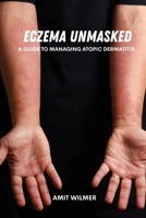 Eczema unmasked: A guide to managing atopic dermatitis B0FD9J6XFH Book Cover