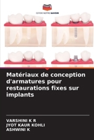 Matériaux de conception d'armatures pour restaurations fixes sur implants 6136348381 Book Cover