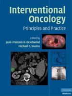 Interventional Oncology: Principles and Practice 0521864135 Book Cover