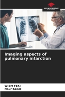 Imaging aspects of pulmonary infarction 6630039378 Book Cover