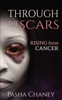 Through the Scars: Rising from Cancer B08BWCD2PN Book Cover