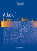 Atlas of Uterine Pathology 3030179303 Book Cover