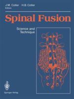 Spinal Fusion: Science and Technique 0387970541 Book Cover