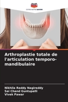 Arthroplastie totale de l'articulation temporo-mandibulaire (French Edition) 6209878393 Book Cover