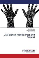 Oral Lichen Planus: Past and Present 3659336025 Book Cover