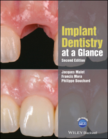 Implant Dentistry at a Glance 1119292603 Book Cover