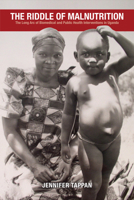 The Riddle of Malnutrition: The Long Arc of Biomedical and Public Health Interventions in Uganda 0821422456 Book Cover