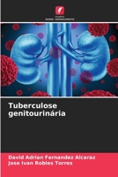 Tuberculose genitourinária (Portuguese Edition) 6206477959 Book Cover