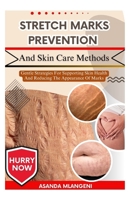 Stretch Marks Prevention And Skin Care Methods: Gentle Strategies For Supporting Skin Health And Reducing The Appearance Of Marks B0FPLSDMNF Book Cover