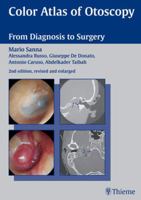 Color Atlas of Otoscopy: From Diagnosis to Surgery 1588901238 Book Cover