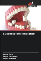 Successo dell'impianto (Italian Edition) 6202666943 Book Cover