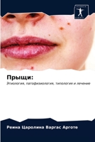 Прыщи:: Этиология, патофизиология, типология и лечение 6203482617 Book Cover