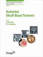 Anterior Skull Base Tumors 3318066699 Book Cover