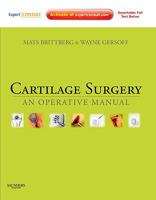 Cartilage Surgery: An Operative Manual, Expert Consult: Online And Print 1437708781 Book Cover