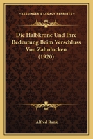 Die Halbkrone Und Ihre Bedeutung Beim Verschluss Von Zahnlucken (1920) (German Edition) 1146086938 Book Cover