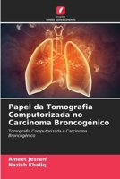 Papel da Tomografia Computorizada no Carcinoma Broncogénico (Portuguese Edition) 6208188946 Book Cover