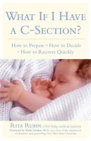 What If I Have a C-Section? 1579549071 Book Cover