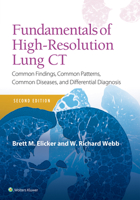 Fundamentals of High-Resolution Lung CT: Common Findings, Common Patterns, Common Diseases and Differential Diagnosis 1496389921 Book Cover