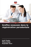 Greffes osseuses dans la régénération parodontale (French Edition) 6207509617 Book Cover