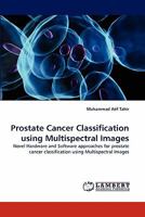 Prostate Cancer Classification using Multispectral Images: Novel Hardware and Software approaches for prostate cancer classification using Multispectral Images 384337922X Book Cover