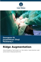 Ridge Augmentation 6207037758 Book Cover