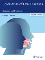 Color Atlas of Oral Diseases : Diagnosis and Treatment 3137170044 Book Cover