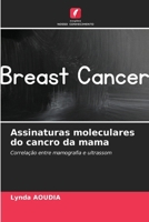 Assinaturas moleculares do cancro da mama (Portuguese Edition) 6207684753 Book Cover