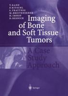 Imaging of Bone and Soft Tissue Tumors 3540650962 Book Cover