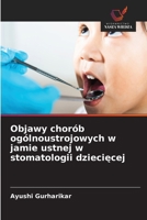 Objawy chorób ogólnoustrojowych w jamie ustnej w stomatologii dzieciecej (Polish Edition) 6208475171 Book Cover