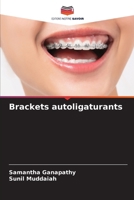 Brackets autoligaturants (French Edition) 6207542355 Book Cover