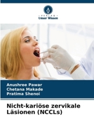 Nicht-kariöse zervikale Läsionen (NCCLs) (German Edition) 6209896278 Book Cover