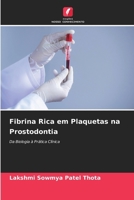 Fibrina Rica em Plaquetas na Prostodontia (Portuguese Edition) 6209736718 Book Cover