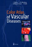 Color Atlas of Vascular Diseases 3642082963 Book Cover