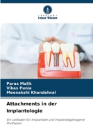 Attachments in der Implantologie: Ein Leitfaden für Implantate und implantatgetragene Prothesen 6206117324 Book Cover